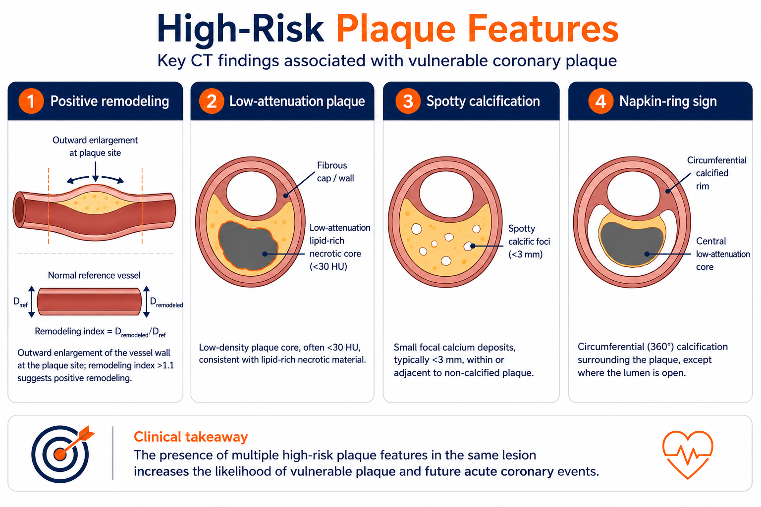 High-risk plaque features on CT — positive remodeling, low-attenuation plaque, spotty calcification, and the napkin-ring sign