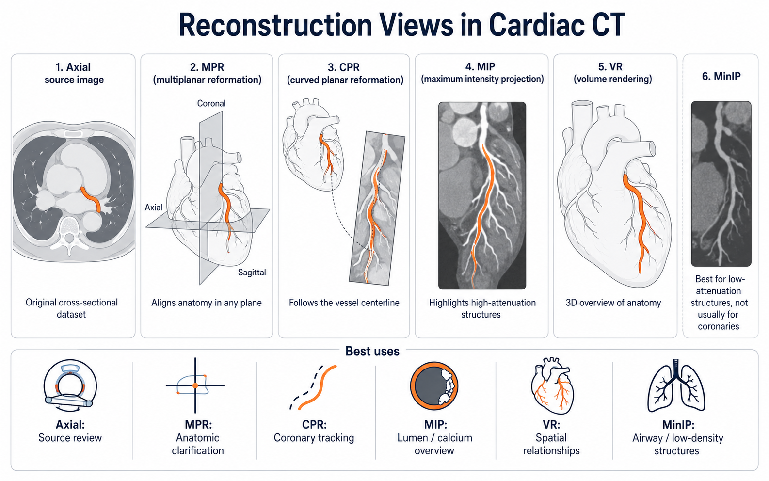 Reconstruction views in cardiac CT — axial source image, MPR, CPR, MIP, VR, and MinIP, with the best use for each
