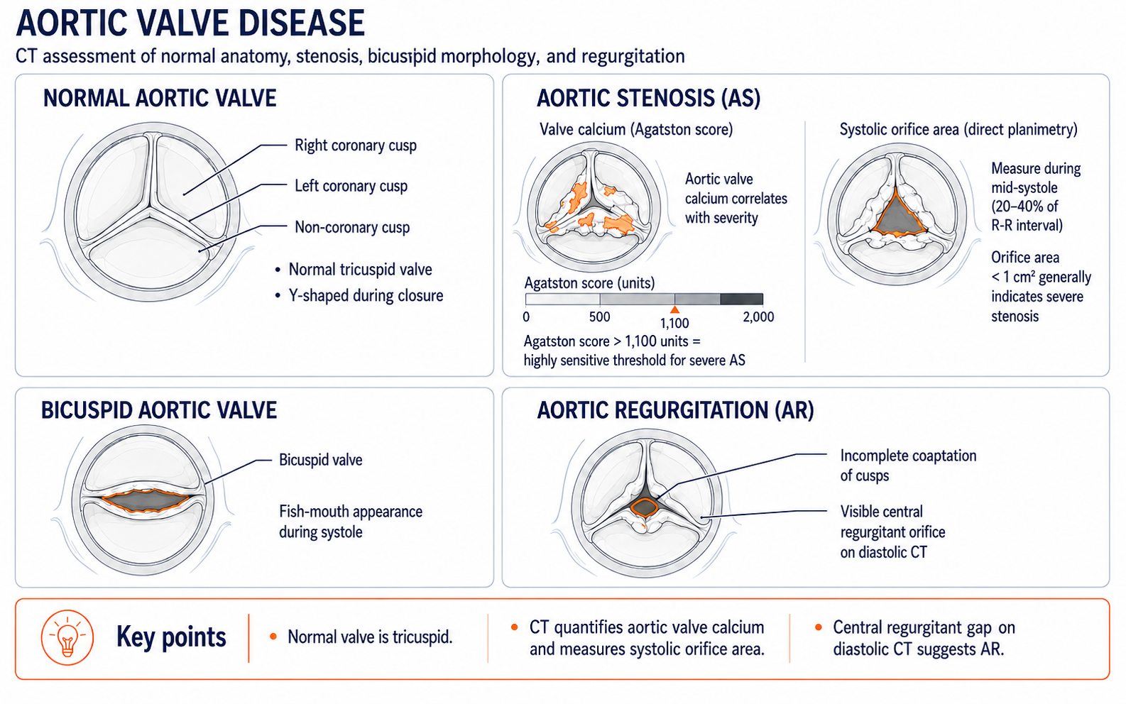 Aortic valve disease on CT — normal tricuspid valve anatomy, aortic stenosis Agatston score and planimetry, bicuspid aortic valve fish-mouth appearance, aortic regurgitation central regurgitant orifice